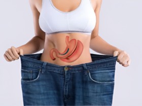 Weight Loss Surgery